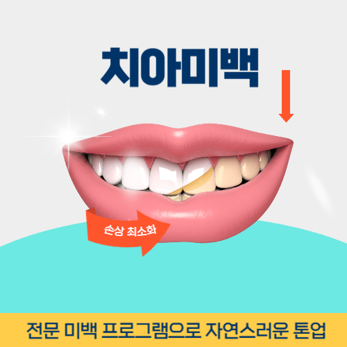 광주치과 광주광역시 치과 치아미백
