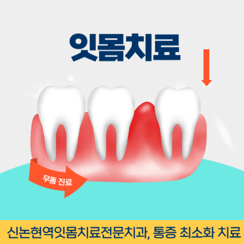 광주치과 광주광역시 치과 잇몸치료